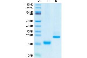 SDS-PAGE (SDS) image for Growth Differentiation Factor 15 (GDF15) (AA 197-307) protein (His tag) (ABIN7274721)