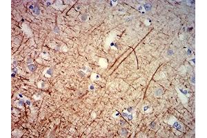 Immunohistochemistry (IHC) image for anti-Neurofilament, Heavy Polypeptide (NEFH) (AA 2-251) antibody (ABIN7193619)