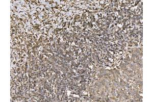 IHC analysis of KIF2A using anti-KIF2A antibody (ABIN7600510). (KIF2A 抗体  (AA 2-706))