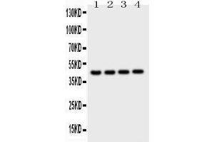 Observed bind size: 45KD (Cathepsin D 抗体  (AA 65-410))