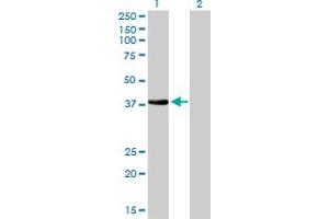 Western Blot analysis of NKX2-5 expression in transfected 293T cell line by NKX2-5 monoclonal antibody (M01), clone 1E4-G5.