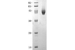 Western Blotting (WB) image for Protein Phosphatase, Mg2+/Mn2+ Dependent, 1A (PPM1A) (Transcript Variant 1) protein (His tag) (ABIN2729792)