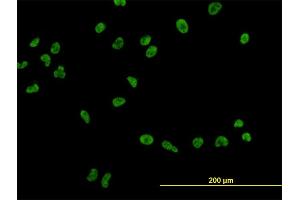 Immunofluorescence of monoclonal antibody to USF2 on HeLa cell. (USF2 抗体  (AA 1-100))