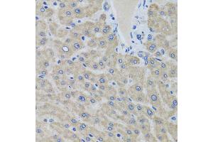 Immunohistochemistry of paraffin-embedded human liver using EIF2S3 antibody (ABIN5975415) at dilution of 1/100 (40x lens). (EIF2S3 抗体)