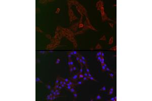 Immunofluorescence analysis of PC-12 cells using GCN2 Rabbit pAb (ABIN6127830, ABIN6140032, ABIN6140034 and ABIN6222976) at dilution of 1:150 (40x lens). (GCN2 抗体  (AA 1-300))