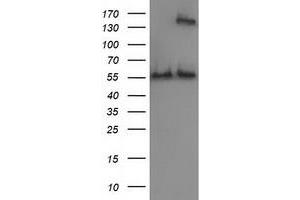 HEK293T cells were transfected with the pCMV6-ENTRY control (Left lane) or pCMV6-ENTRY CAT (Right lane) cDNA for 48 hrs and lysed. (Catalase 抗体)