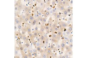 Immunohistochemistry of paraffin-embedded Human liver using IGF1 antibody (ABIN1682184, ABIN3015345, ABIN3015346 and ABIN7101347) at dilution of 1:100 (40x lens). (IGF1 抗体)