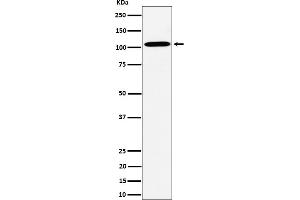 Western blot analysis of USO1 expression in HepG2 cell lysate.