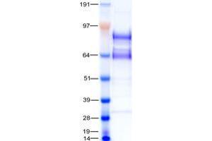Validation with Western Blot