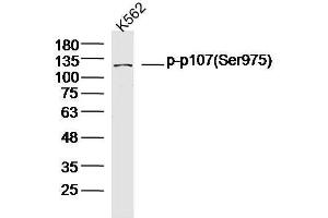 Human K562 cells probed with p107(Ser975) Polyclonal Antibody, unconjugated  at 1:300 overnight at 4°C followed by a conjugated secondary antibody at 1:10000 for 90 minutes at 37°C. (p107 抗体  (pSer975))