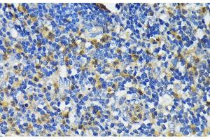Immunohistochemistry of paraffin-embedded Human appendix using CAMP Polyclonal Antibody at dilution of 1:200 (40x lens). (Cathelicidin 抗体)