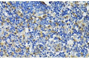 Immunohistochemistry of paraffin-embedded Human appendix using CAMP Polyclonal Antibody at dilution of 1:200 (40x lens).