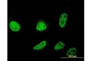 Image no. 2 for anti-Cold Shock Domain Containing C2, RNA Binding (CSDC2) (AA 1-154) antibody (ABIN466198) (CSDC2 抗体  (AA 1-154))