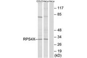 Western blot analysis of extracts from HeLa/COLO cells, using RPS4X Antibody. (RPS4X 抗体  (AA 81-130))