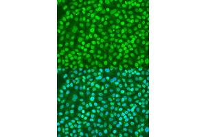 Immunofluorescence analysis of U2OS cells using BDNF antibody (ABIN1871274) at dilution of 1:100. (BDNF 抗体)