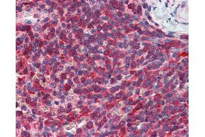 Immunohistochemistry (IHC) image for anti-Phosphatidylinositol-5-Phosphate 4-Kinase, Type II, alpha (PIP4K2A) (AA 304-366) antibody (ABIN790560)