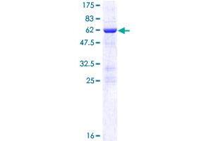NOSIP Protein (AA 1-301) (GST tag)