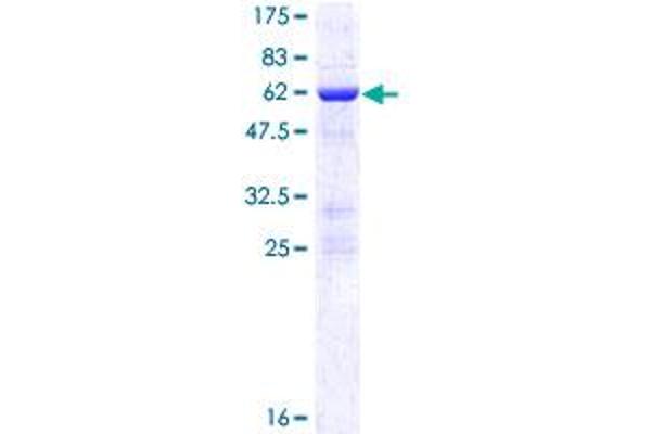 NOSIP Protein (AA 1-301) (GST tag)