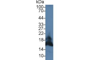 Detection of FASL in Mouse Pancreas lysate using Polyclonal Antibody to Factor Related Apoptosis Ligand (FASL) (FASL 抗体  (AA 132-279))