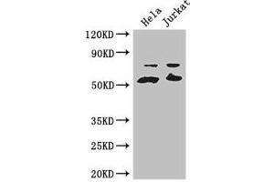 Western Blot Positive WB detected in: Hela whole cell lysate, Jurkat whole cell lysate All lanes: YES1 antibody at 3. (YES1 抗体  (AA 1-155))