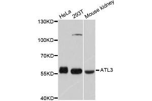 Western blot analysis of extracts of various cell lines, using ATL3 antibody (ABIN5997276) at 1/1000 dilution. (ATL3 抗体)