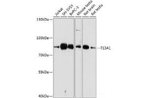 Western blot analysis of extracts of various cell lines using F13A1 Polyclonal Antibody at dilution of 1:3000. (F13A1 抗体)