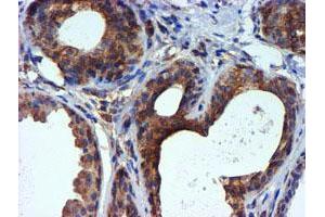 Immunohistochemical staining of paraffin-embedded Human breast tissue using anti-TUBAL3 mouse monoclonal antibody.