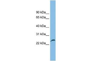 WB Suggested Anti-GSTK1 Antibody Titration: 0. (GSTK1 抗体  (Middle Region))