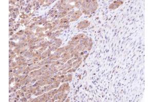 IHC-P Image Immunohistochemical analysis of paraffin-embedded NCIN87 xenograft, using STK25, antibody at 1:100 dilution. (STK25 抗体)