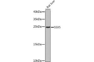 Western blot analysis of extracts of Rat liver, using SSX5 Rabbit pAb  at 1:1000 dilution. (SSX5 抗体  (AA 1-229))