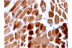Formalin-fixed, paraffin-embedded human Cardiac Muscle stained with Sarcomeric Actinin Alpha 2 Mouse Monoclonal Antibody (ACTN2/3292). (ACTN2 抗体  (AA 557-692))