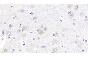 Detection of Cys-C in Porcine Cerebrum Tissue using Polyclonal Antibody to Cystatin C (Cys-C) (CST3 抗体  (AA 42-127))
