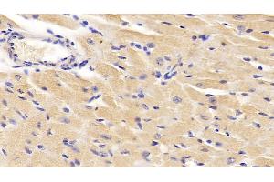 Detection of DBI in Mouse Cardiac Muscle Tissue using Polyclonal Antibody to Diazepam Binding Inhibitor (DBI) (Diazepam Binding Inhibitor 抗体  (AA 2-87))