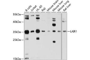 Western blot analysis of extracts of various cell lines, using L antibody (ABIN6131546, ABIN6143063, ABIN6143064 and ABIN6214255) at 1:1000 dilution. (LAIR1 抗体)