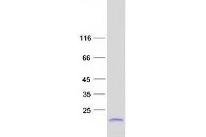 Western Blotting (WB) image for Small Proline-Rich Protein 2F (SPRR2F) protein (Myc-DYKDDDDK Tag) (ABIN2732620)