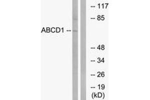 Western Blotting (WB) image for anti-ATP-Binding Cassette, Sub-Family D (Ald), Member 1 (ABCD1) (AA 531-580) antibody (ABIN2890147) (ABCD1 抗体  (AA 531-580))
