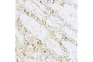 Immunohistochemistry (IHC) image for anti-Branched Chain Amino-Acid Transaminase 2, Mitochondrial (BCAT2) (AA 20-200) antibody (ABIN6137483)