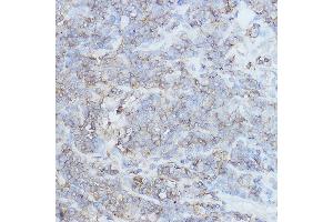 Immunohistochemistry (IHC) image for anti-CD44 (CD44) (AA 148-247) antibody (ABIN6138193)