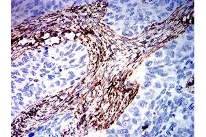 Immunohistochemistry (IHC) image for anti-Vimentin (VIM) (AA 2-466) antibody (ABIN7193582)