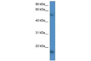 Human HepG2; WB Suggested Anti-GPT2 Antibody Titration: 0. (GPT2 抗体  (C-Term))