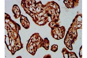 Immunohistochemistry (IHC) image for anti-Guanine Nucleotide Binding Protein (G Protein) alpha 12 (GNA12) (AA 112-270) antibody (ABIN7154731)