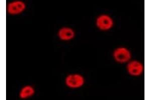 ABIN6278578 staining MCF7 by IF/ICC. (HES6 抗体  (N-Term))