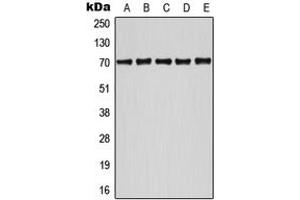 Western blot analysis of ATF2 (pS498) expression in HeLa UV-treated (A), Jurkat (B), NIH3T3 (C), SP2/0 UV-treated (D), MCF7 UV-treated (E) whole cell lysates. (ATF2 抗体  (C-Term, pSer498))