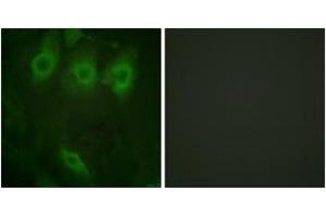 Immunofluorescence analysis of HeLa cells, using EGFR (Phospho-Tyr1016) Antibody. (EGFR 抗体  (pTyr1016))