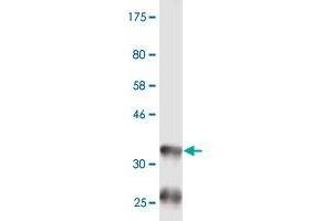 Western Blot detection against Immunogen (36. (BAAT 抗体  (AA 258-355))