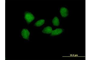Immunofluorescence of purified MaxPab antibody to SOX6 on HeLa cell. (SOX6 抗体  (AA 1-828))