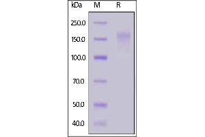 Human CD45, His Tag on  under reducing (R) condition. (CD45 Protein (AA 26-577) (His tag))