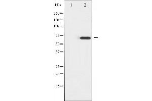 Western blot analysis of ZAP-70 expression in Jurkat whole cell lysates,The lane on the left is treated with the antigen-specific peptide. (ZAP70 抗体  (Internal Region))