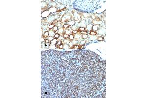 Immunohistochemical staining (Formalin-fixed paraffin-embedded sections) of (A) human tonsil and (B) human pancreas with Mitochondria monoclonal antibody, clone AE-1 . (Mitochondria 抗体)