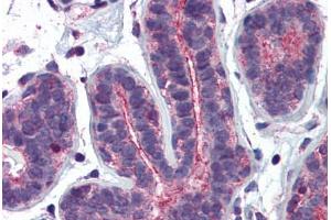 Human Breast: Formalin-Fixed, Paraffin-Embedded (FFPE) (RHOA 抗体  (AA 1-194))